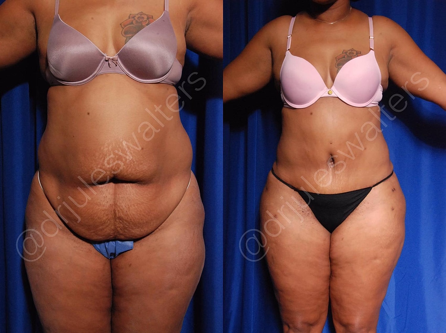 Before and after body image transformation comparison.