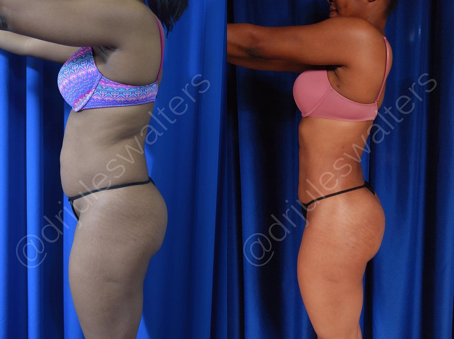 Body transformation photo comparison side view.