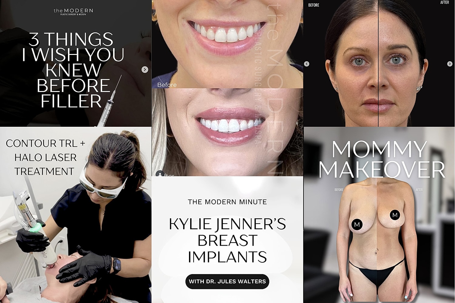 Plastic surgery and aesthetic treatment advertisements collage.