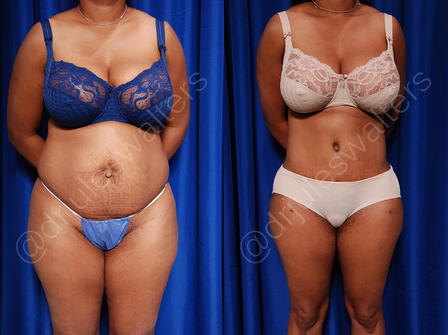 Before and after body transformation images.