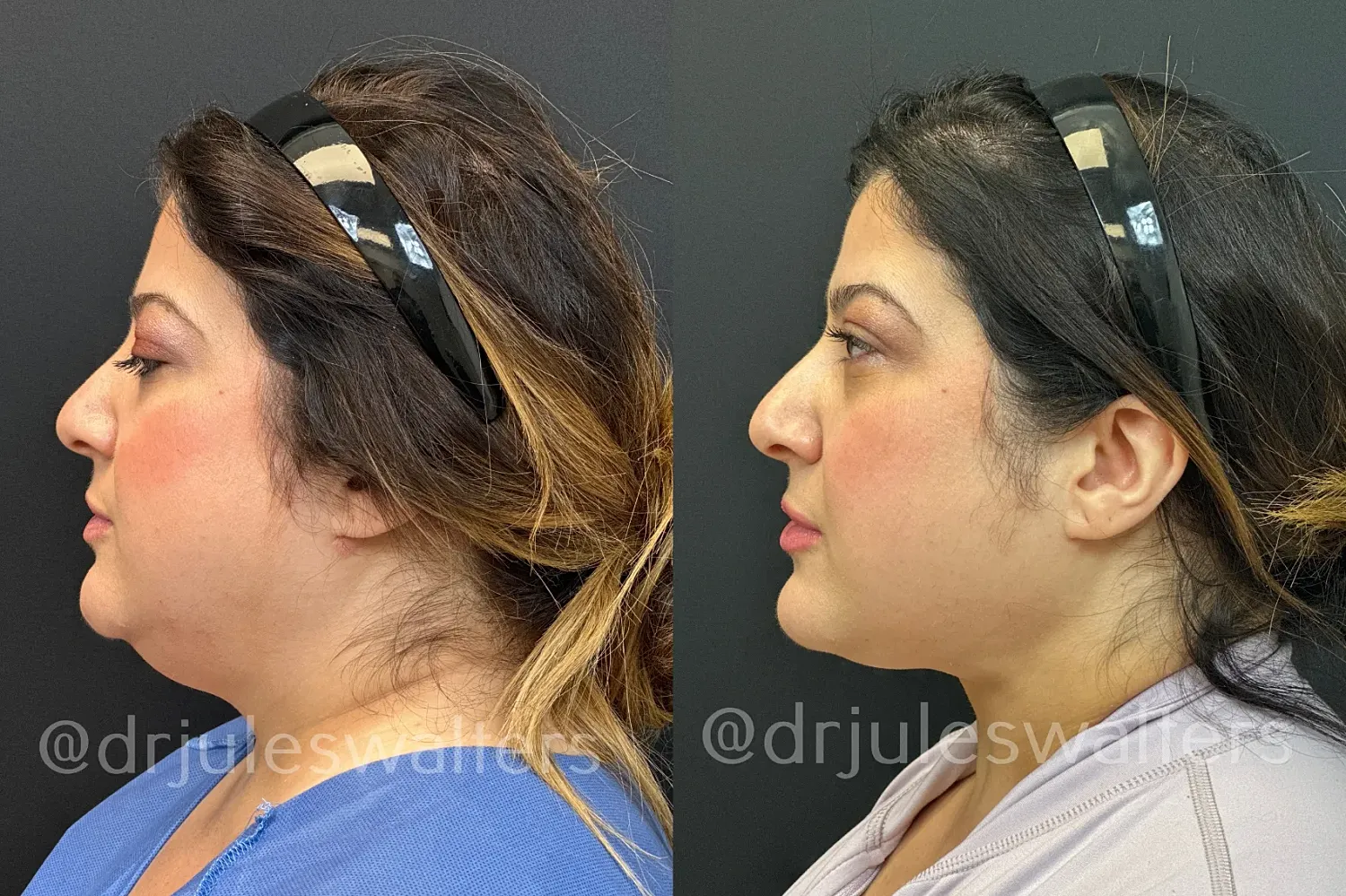 Before and after profile photo comparison.